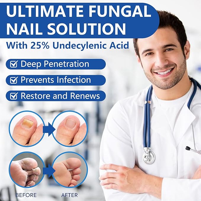 Toenail Fungus Treatment Extra Strength, Nail Fungus Treatment with 25% Undecylenic Acid, Upgraded Fungal Nail Repair for Yellow, Discolored, Thick and Ingrown Nails, 2 Bottles
