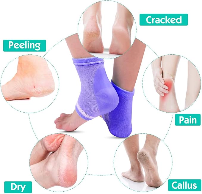 Selizo 6 Pairs Heel Moisturizing Socks Open Toe Socks Cracked Gel Heel Socks Foot Toeless Heel Repair Socks for Women Dry Hard Cracked Feet, 6 Colors
