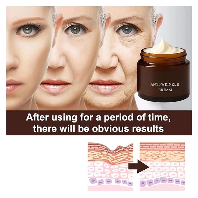 2PCS Retinol Anti-Wrinkle Cream, Firms and Lifts Skin, Effectively Reduces Wrinkles and Fine Lines, Deeply Moisturizes