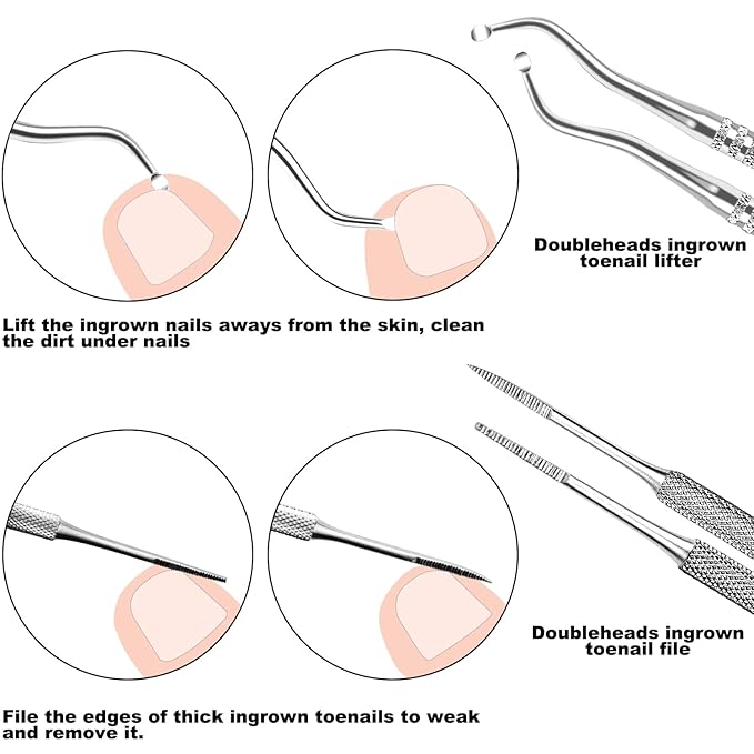 ZIZZON 7 Pcs Ingrown Toenail File and Lifters Set, Stainless Steel Ingrown Toenail Removal Kit, Under Nail Cleaner Pedicure Tools