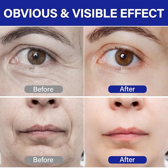 PDRN Serum丨Lifts and firms, Reduces Wrinkles, Deeply Moisturizes丨Peptides, PDRN丨Anti-aging, Improves Dullness