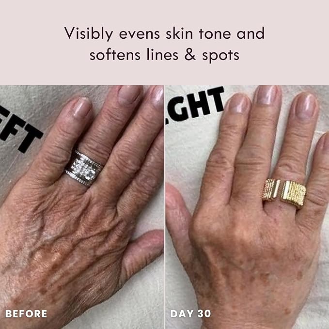 Laduora Lumeo 4-in-1 SkinLift Beauty Device + Serum Kit | Pro Glow System for Face & Neck