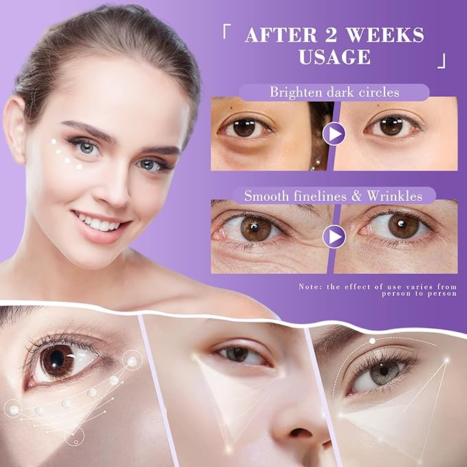 Eye Cream, Retinol Eye Cream for Dark Circles, Puffiness Anti Aging, With Hyaluronic Acid, Peptides, Caffeine Reduces Bags, Smooths Wrinkles & Fine Lines