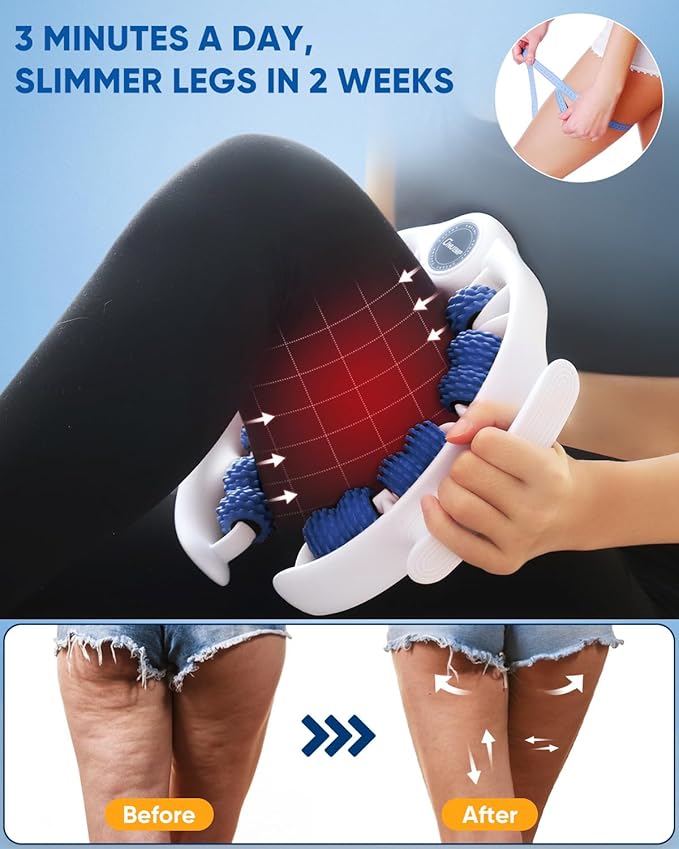 ONUEMP Cellulite Massage Tool, Lymphatic Drainage Cellulite Remover for Legs, Muscle Roller Fascia Massage - Body Sculpting, Lipedema Massagers, Celulitis Reduccion, Deep Tissue Pain Relief, Blue