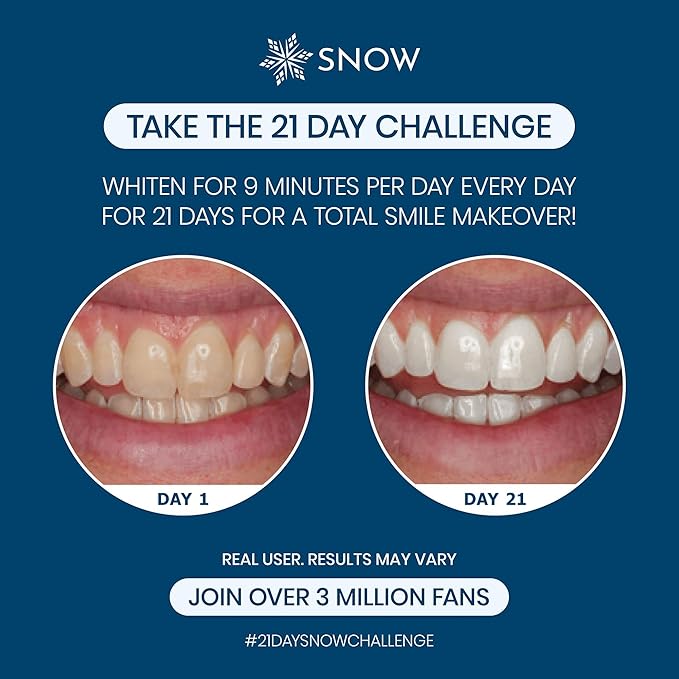 Snow Teeth Whitening Kit - Snow Teeth Whitening Serum and LED Mouthpiece Whitener, Formulated with Hydroxyapatite, Good for 6 Months - Wired Kit with 3 Wands