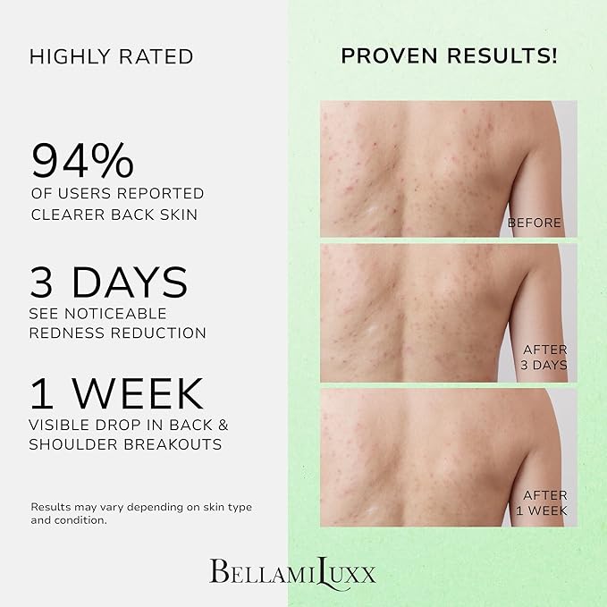 Back & Body Acne Spray Treatment: 2% Salicylic Acid & Tea Tree Oil Bacne Spray for Clear, Soothe & Moisturize - Effective for Men, Women, Teens with Back, Chest, Shoulder, Arm Acne