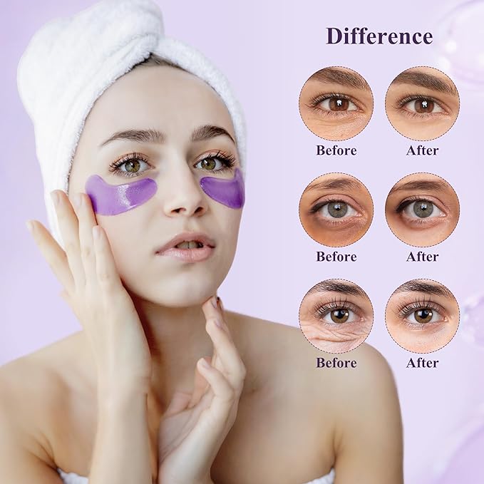 Under Eye Patches (30 Pairs), Under Eye Mask for Puffy Eyes and Dark Circles, Eye Masks with Collagen, Relieves Pressure and Reduces Wrinkles, Revitalises and Refreshes Your Skin, Lavender