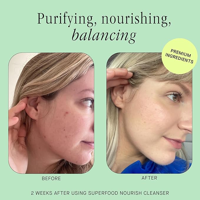 Brandefy Superfood Face Wash, Gentle & pH Balanced Cleanser w/Kale, Green Tea, Spinach, Vitamin C, E, K2- Softens & Nourishes Skin, Organic Facial Cleanser for All Skin Types (8 Fl Oz)