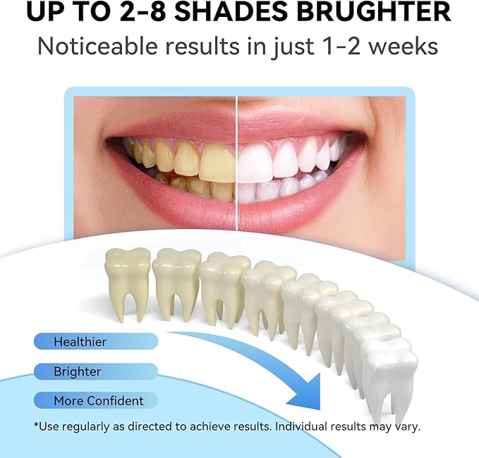 JTF Teeth Whitening Gel Kit: 35% Carbamide Peroxide, 5Pcs Teeth Whitener Gels and 1 Remineralization Gel to Remove Stains from Coffee Food and Smoking, Enamel Safe and No Sensitivity, Mint