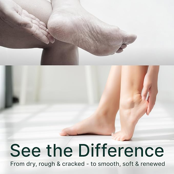 YOGAMEDIC Foot Care Kit - 3 Hydrating & Exfoliating Foot Masks for Dry Feet & 2 Cork Massage Balls for Relaxation