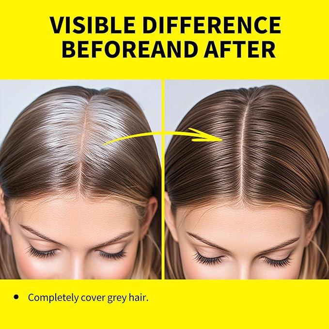 SEVICH Dual-Ended Root Touch Up Stick - Waterproof Hairline Enhancer for Sparse Hairlines & Gray Coverage, Non-Sticky Scalp Concealer with Beeswax, Instant Volume & Natural Look (Dark brown)