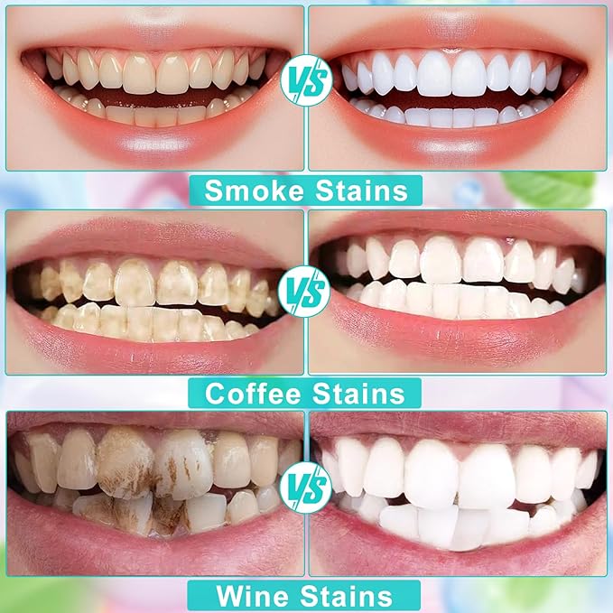 Niacinamide Whitening Toothpaste Natural Mild and Non-Irritating Nicotinamide White Toothpaste Prevents Tooth Decay Freshens Breath, and Promotes Oral Health