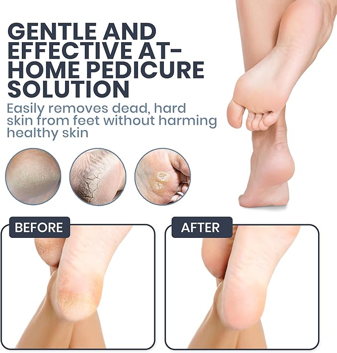 Upgraded 2025 Electric Foot File – Callus Remover for Women & Men with Adjustable Speed, 60 Sanding Pads & Dead Skin Exfoliation – at-Home Pedicure Tool for Dry, Cracked Feet (Pink)