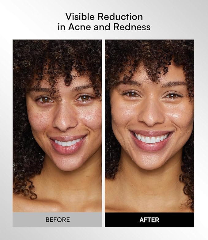 INIA Red Light Therapy Mask for Face, Glow Wireless LED Face Mask Light Therapy with Near-Infrared Red Light (NIR), Rechargeable and Ergonomic Design for Home & Travel