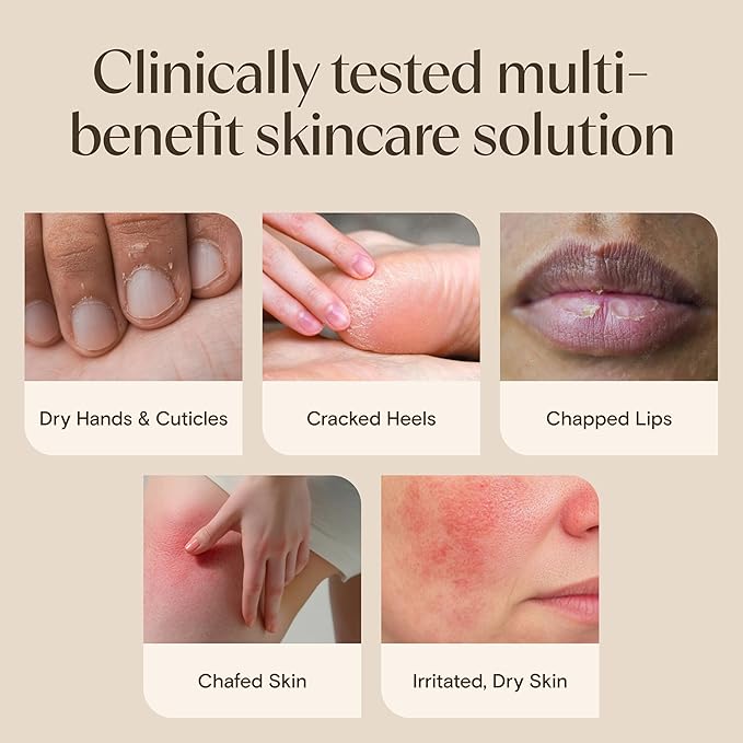 Aveeno Skin Relief Healing Ointment, Repair & Protect Extra Dry, Cracked Skin, Glycerin Protectant with Triple Oat & Shea Butter, Fragrance-Free & Non-Greasy Feel, Travel Size, 2.0 oz