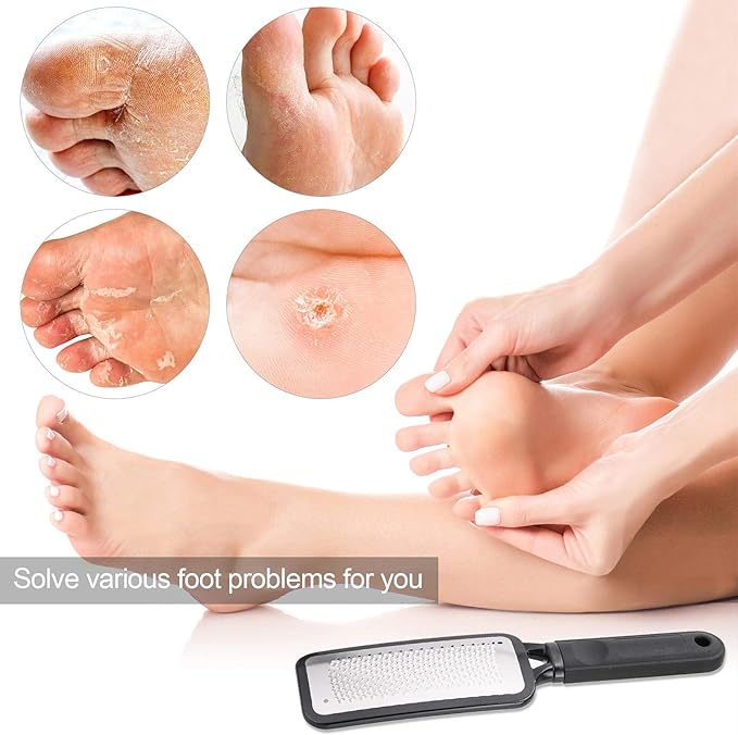 Foot Scrubber Foot Files Callus Remover Black Heel Grater Dead Skin Remover Stainless Steel Heel Scraper for Cracked Heels