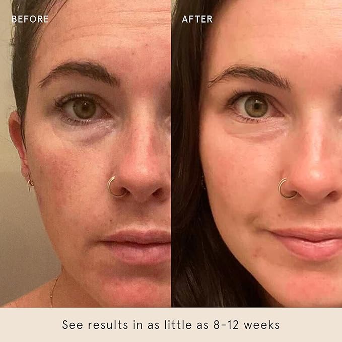 Barefaced Serum Duo - RetinAL & Overachiever to Improve Skin Firmness, Strengthen Skin Barrier, & Boost Retinoid Results