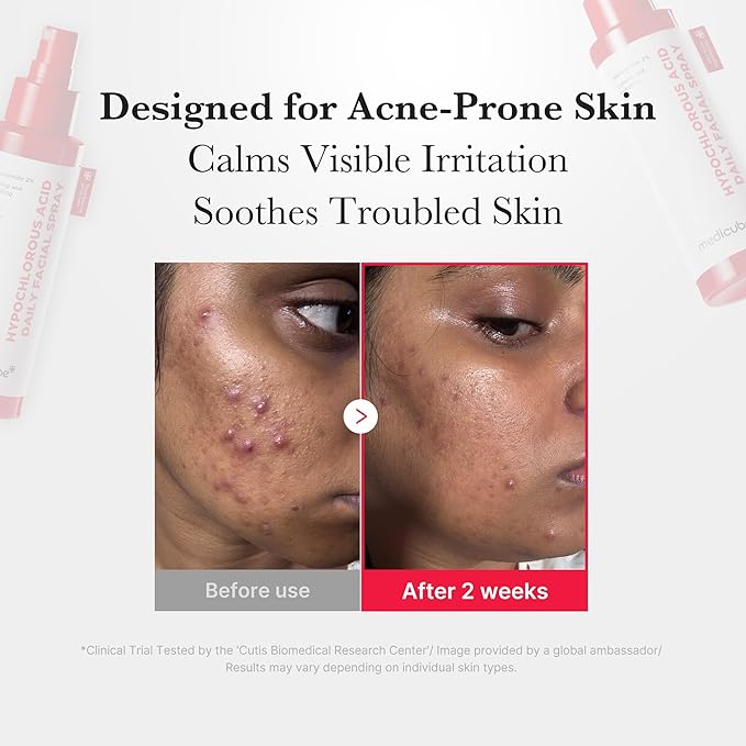 medicube Sun Care On-The-Go Duo: Collagen Glow Sunscreen and Mini Power Soothing Spray for Daily Sun Care and Hydration | Travel Essentials, Giftable Skincare Set