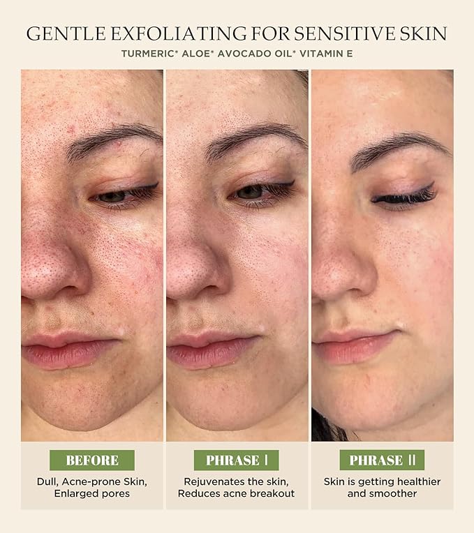 Vitamin C and Turmeric Face Scrub, Face Scrub for All Skin Types -Physical Scrub to Exfoliate Face & Body, Anti Aging Facial Exfoliating Scrub, Clears Blackheads Improve Dark Spots 4.23 Oz