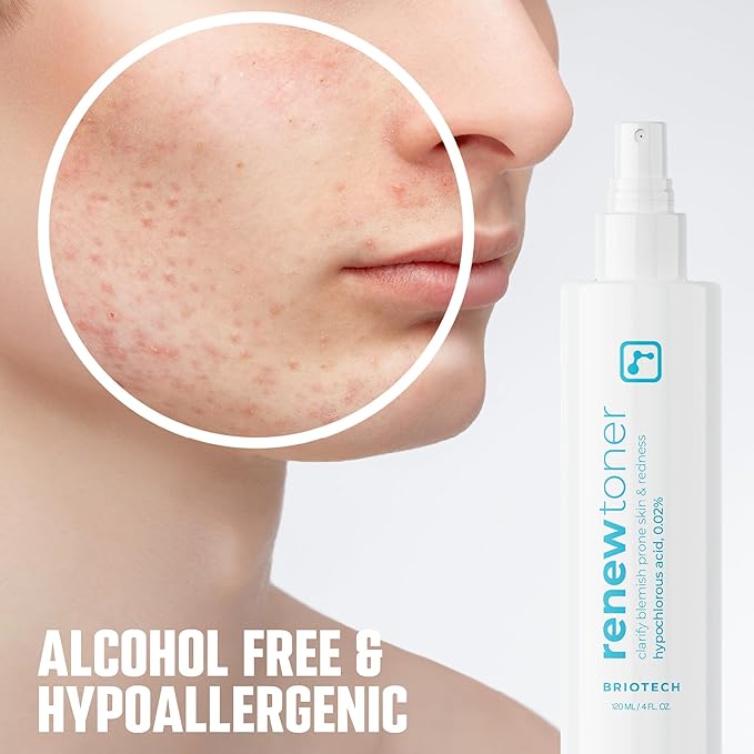 BRIOTECH Renew Toner, Hypochlorous Acid Spray, Minimize Appearance of Blemishes, Soothing Facial Mist for Sensitive Skin, Calm Redness & Bumps, Vegan, 4 fl oz (4 Pack)