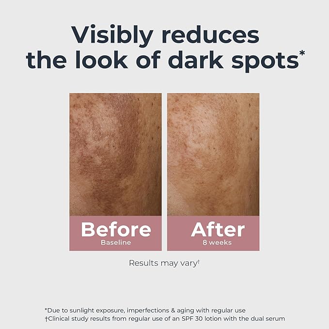 Eucerin Radiant Tone Dual Serum Dark Spot Corrector, Dark Spot Serum with Thiamidol and Hyaluronic Acid, Helps Visibly Reduce the Look of Dark Spots, Holiday Gifts for Self Care, 1 Fl Oz Bottle