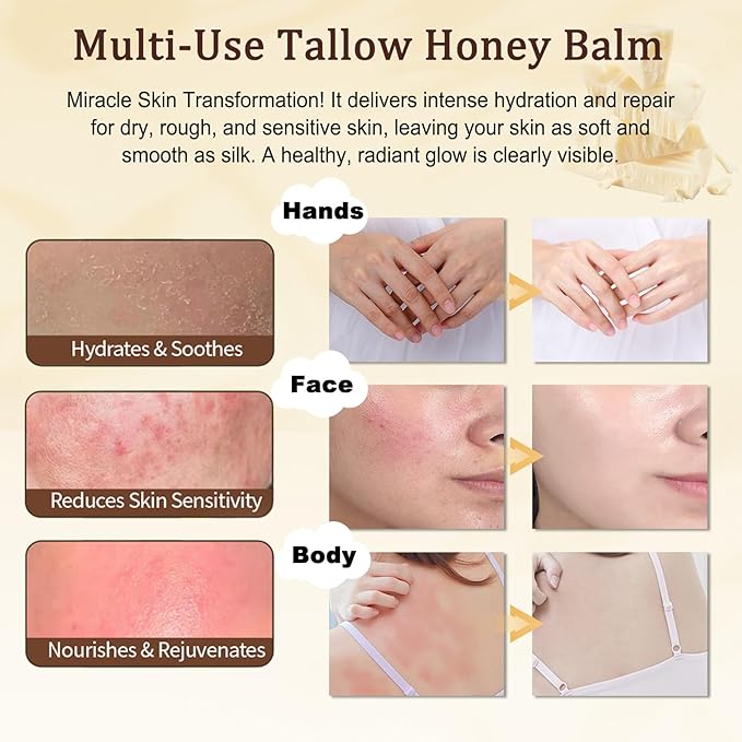 Beef Tallow for Skin, Organic Grass-Fed Tallow and Honey Balm with Row Wild Honey, Deeply Moisturizes Face & Body Moisturizer, Natural Formula for Dry & Sensitive Skin (2 OZ, Citrus)