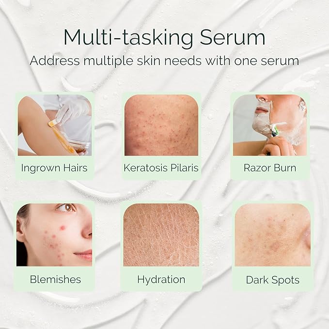 Serious Serum Exfoliating Ingrown Hair Serum – Glycolic, Lactic & Salicylic Acid Formula for Smooth Skin – Razor Bumps, Ingrown Hairs & Razor Burn – Hydrating Formula for Post-Shave & Waxing Care
