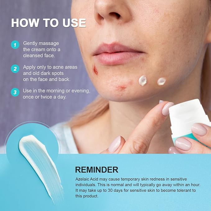 Acne Pimple Spot Treatment Cream: Cystic Hormonal Blackheads Blemish Remover for Face, Back and Body - with 2% Salicylic Acid - Teens 13-19 & Young Adult 20-30, 1.8 oz