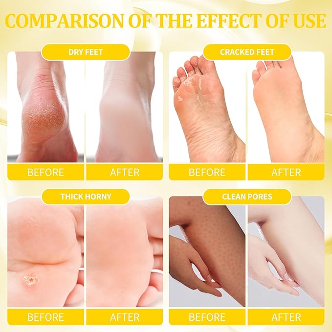 Pedicure Kit Foot Soak Set: Bubble Salt, Sugar Scrub, Massage Mask, Massage Lotion in a Box, 4 Step Foot Spa Kit for Dry Feet, Calluses and Tired Feet(1 Set Milky Flower)