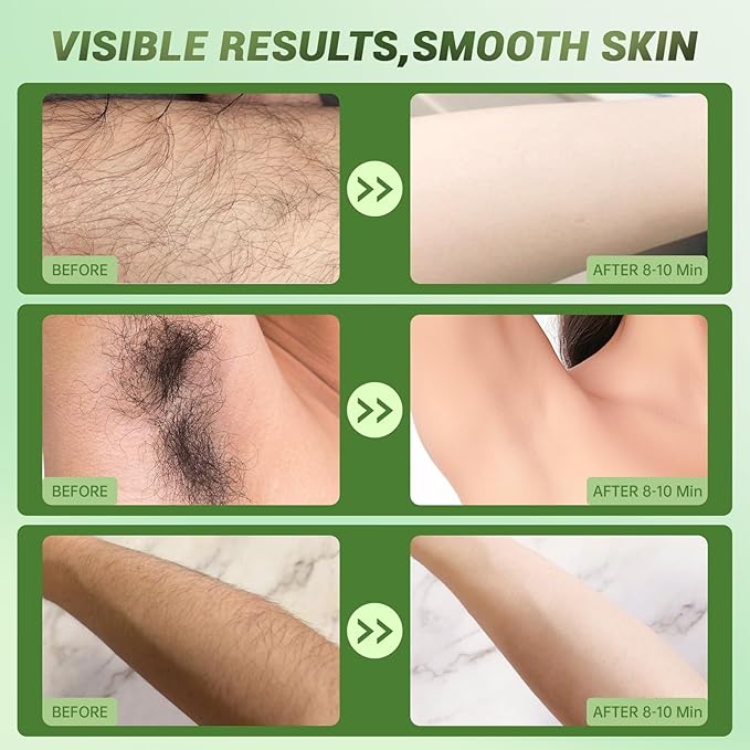 Hair Removal Cream For Women - Painless Body Hair Remover Sensitive Skin Hair Removal For Back Legs Fast And Gentle 3.38 Fl Oz