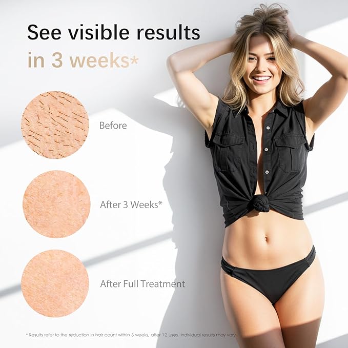 Laser Hair Removal, IPL Laser Hair Removal Device for Women & Men, Safe at-Home Nearly Painless 45°F Ice-Cooling Contact, Long-Lasting Result for Full Body & Face, Purple