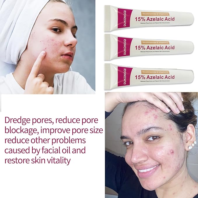 Azelaic Acid for Face Balance Skin Tone & Cleanse Pores, Azelaic Acid Serum-Relieve Acne, Blackhead & Redness,Premium Skin Care,20g(1 Pcs) (2PCS, Gram, 20)