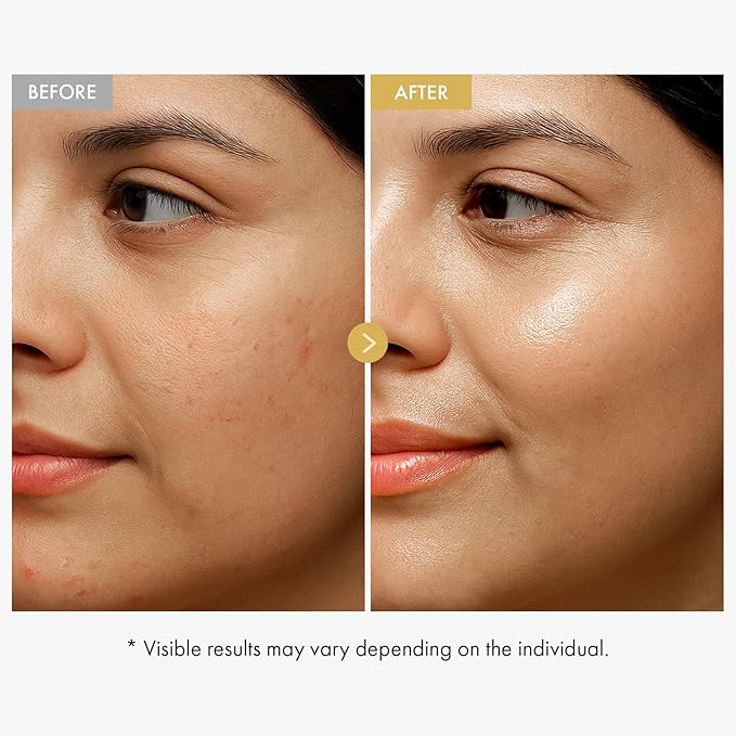 TOSOWOONG Glow Bean Face Cream, 63,844ppm Soybean Ferment Extract, Korean Skincare for Glass Skin, Moisturizer, Relief, Smooth, Nourished Skin, Anti-Aging, Hydrating, K Beauty, 50 ml / 1.69 fl. oz.