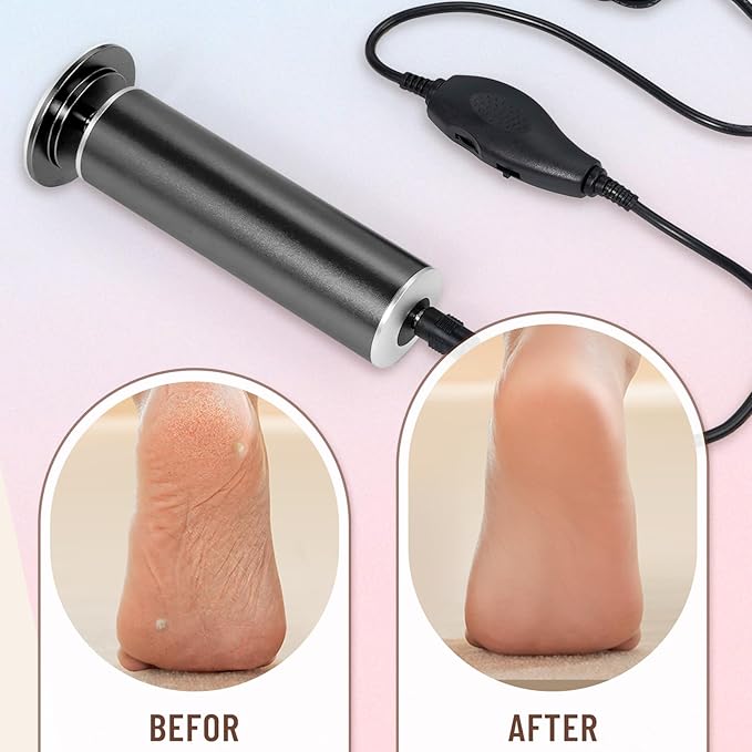 Dermawave Electric Foot File Callus Remover for Feet, Professional Foot Scrubber Sander Grinder for Dead Skin Cracked Heel, Pedicure Tool with 60 Sandpaper Discs for Men & Women