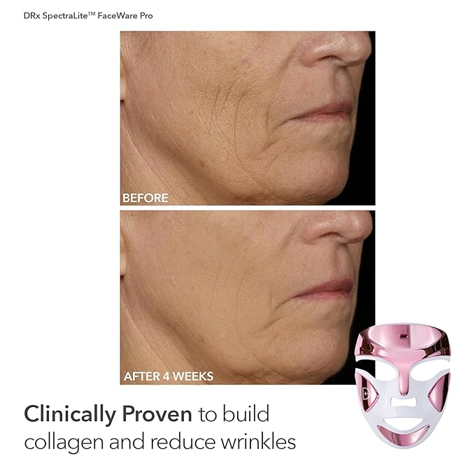 Dr Dennis Gross Boost Collagen, Brighten & Firm Kit – Pink dpl Faceware Pro LED Device + Cleansing Oil + Dewy Deep Cream + 5 Universal Daily Peels | $592 Value Limited Edition Gift Set