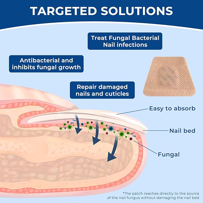 Toenail Fungus Treatment Extra Strength - 32 Pcs Fungal Nail Patches, 8-Hour Nighttime Renewal Toenail Fungus Patches for Damaged Nails and Appearance of Discolored