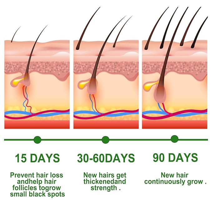 Rosemary Essential Oil for Hair Growth & Scalp Care - 3.38 Fl Oz (100ml) 100% Pure Organic Cold Pressed Oil in Glass Bottle - Aromatherapy Diffuser, Skin & Nail Treatment(Large, Rosemary)