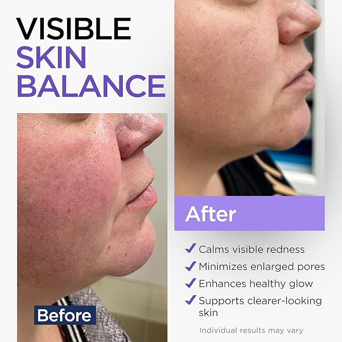 Niacinamide Serum for Face 10% with Zinc 1% Vitamin B3 Anti-Aging, Advanced Skin Care for Even Tone, Texture and Hydrating Cruelty Free 2 Oz