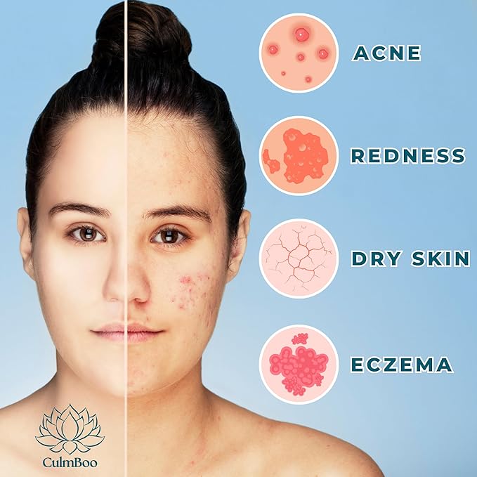 Hypochlorous Acid Spray for Face & Skin – HOCl Facial Toner & Hydrating Mist for Sensitive, Acne-Prone Skin – Soothing pH-Balanced Formula for Daily Refresh, Cleansing & Redness Support – 8 oz