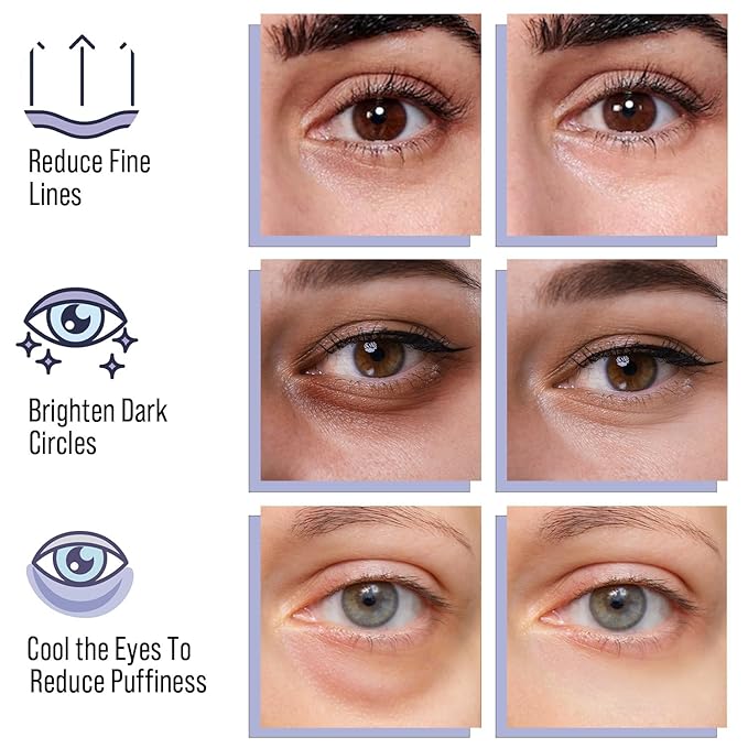 DIAMOND GAZE Firming Hydrogel Eye Patches 28 Pairs, 5-Min Retinol & Niacinamide Eye Masks to Smooth and Brighten, Reduce Fine Lines & Dark Circles, Relaxing Gifts for Her Holiday Set