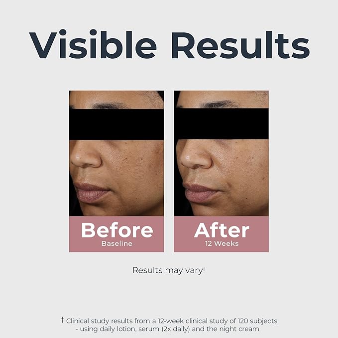 Eucerin Radiant Tone Dual Serum Dark Spot Corrector, Dark Spot Serum with Thiamidol and Hyaluronic Acid, Helps Visibly Reduce the Look of Dark Spots, Holiday Gifts for Self Care, 1 Fl Oz Bottle