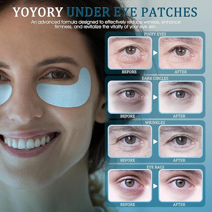 Under Eye Patches Masks - for Fine Lines with Collagen and Hyaluronic Acid, Dark Circles,and Fade Wrinkles, puffiness Smoothing Skin Care Treatment for Women and Men, (30 Pcs) white