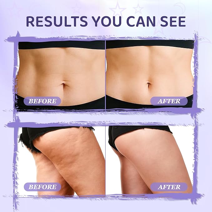 MYTH-Dreamy Overnight Toning Whip Firming Cellulite Cream, Skin Firming and Tightening Lotion While You Sleep - Helps Tighten Loose Skin & Cellulite on Body Belly Booty Arms Thighs with Gua Sha Tool