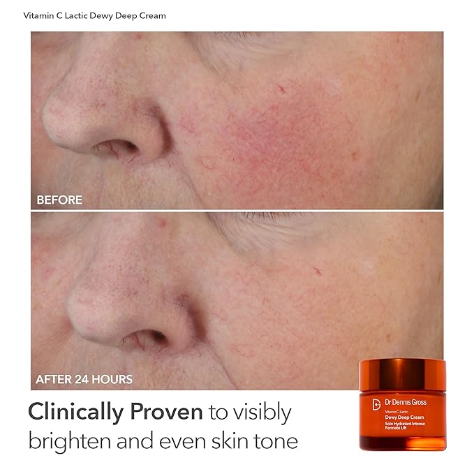 Dr Dennis Gross Boost Collagen, Brighten & Firm Kit – Pink dpl Faceware Pro LED Device + Cleansing Oil + Dewy Deep Cream + 5 Universal Daily Peels | $592 Value Limited Edition Gift Set