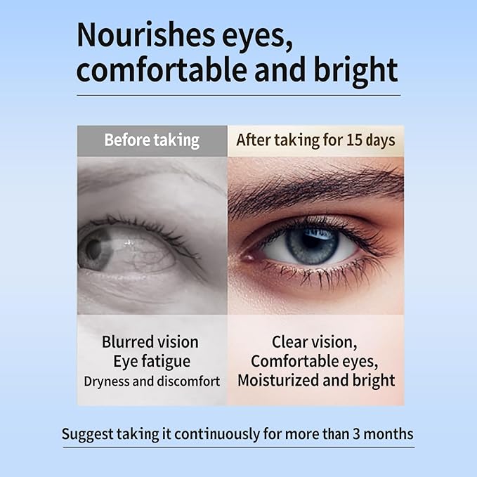 AREDS 2 Vitamins 120 Softgels Containing Lutein and Zeaxanthin Supplements Do A Good Eye Vitamins and Supplements Mineral Supplements