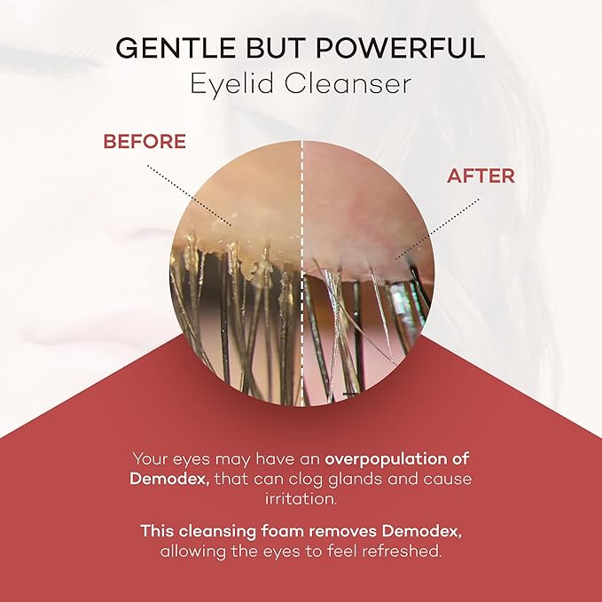 Zocular ZocuFoam Eyelid Cleanser - Foaming Eyelid Scrub - Natural pH Balanced Solution - 25mL