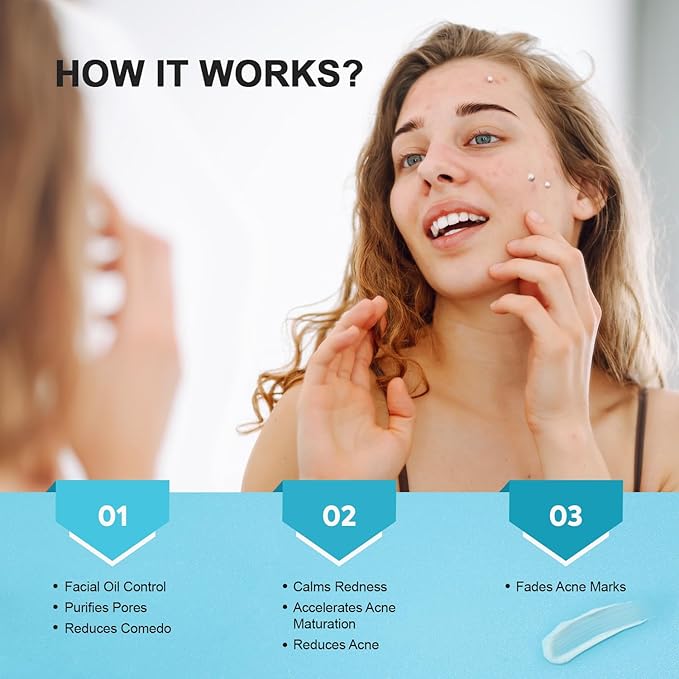 Acne Pimple Spot Treatment Cream: Cystic Hormonal Blackheads Blemish Remover for Face, Back and Body - with 2% Salicylic Acid - Teens 13-19 & Young Adult 20-30, 1.8 oz