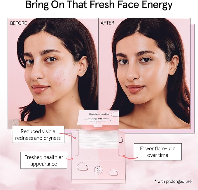 grace & stella Disposable Face Towels - Travel Essentials - Ultra-Soft & Absorbent Face Wipes Towelettes - XL Facial Towels for Cleansing & Makeup Removal - Lint-Free Facial Tissue - Vegan (60 Count)