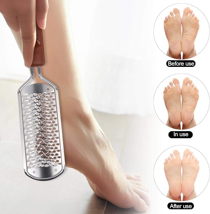 2 Pieces Colossal Foot Rasp Foot Files Callus Remover Foot Scrubber, Stainless Steel Feet Grater Heel File Foot Pedicure Tools for Dry Cracked Heels