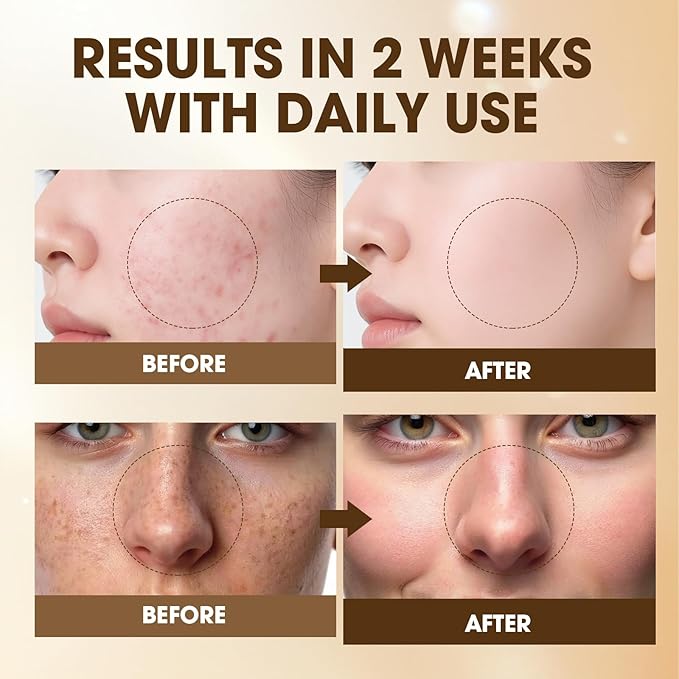 Salmon Caring Ampoule – Salmon DNA (PDRN) & Salmon Egg Extract, Chamomile Extract & Madecassoside | Soothing, Hydrating & Restoring for Sensitive Skin